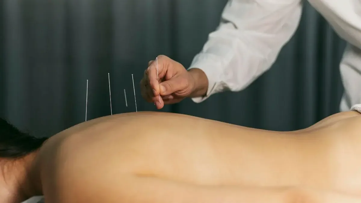 Acupuntura como funciona em condições musculoesqueléticas