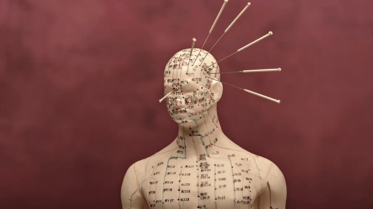 Acupuntura: Como saber se está funcionando