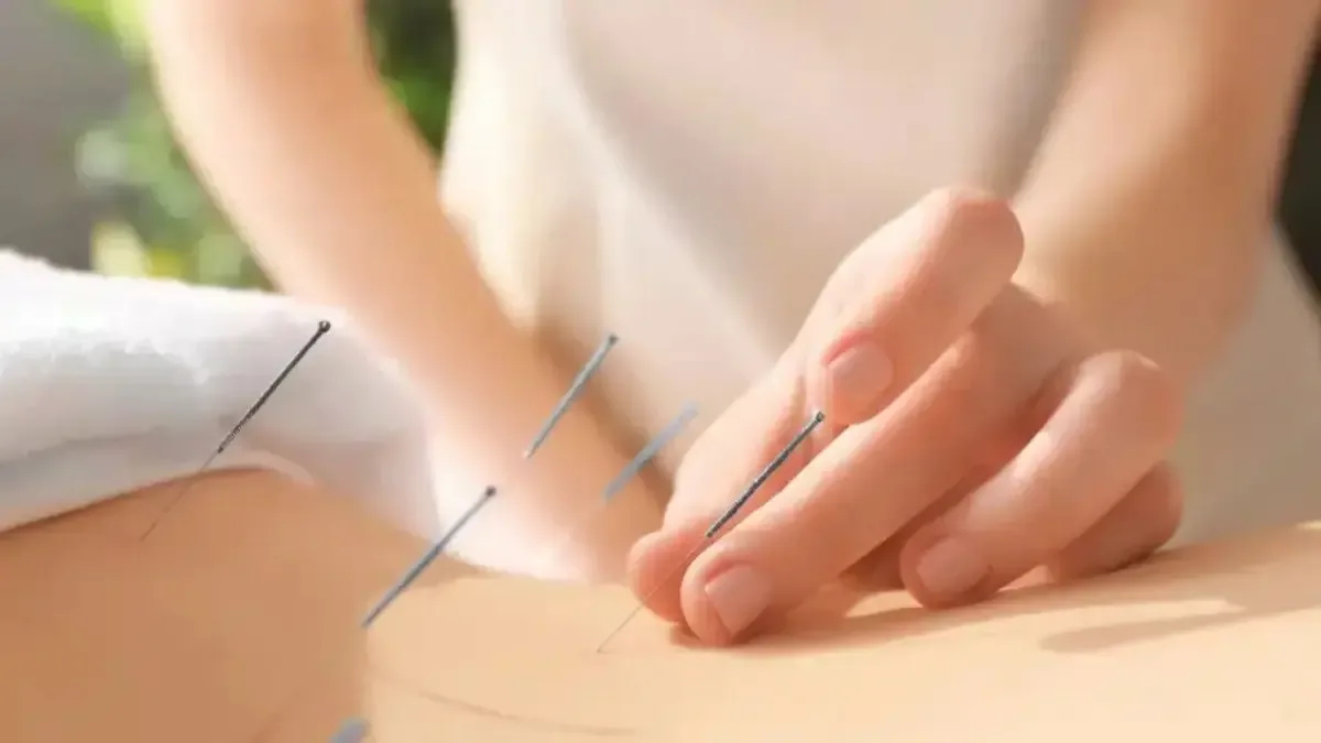 Acupuntura para bico de papagaio