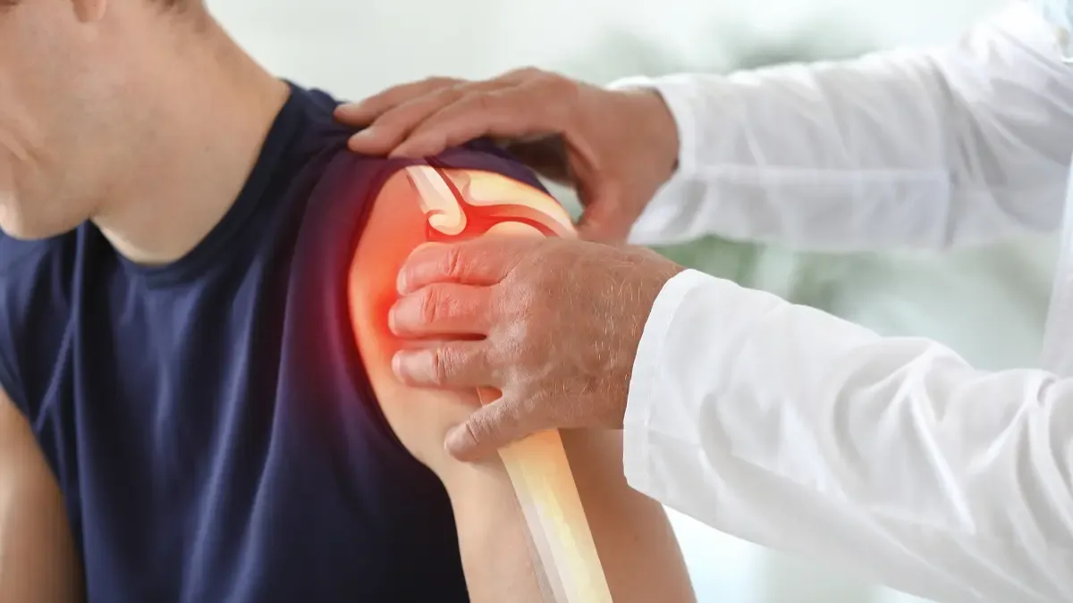 Calcificação No Ombro: Tendinite Calcária Dor Ao Levantar O Braço