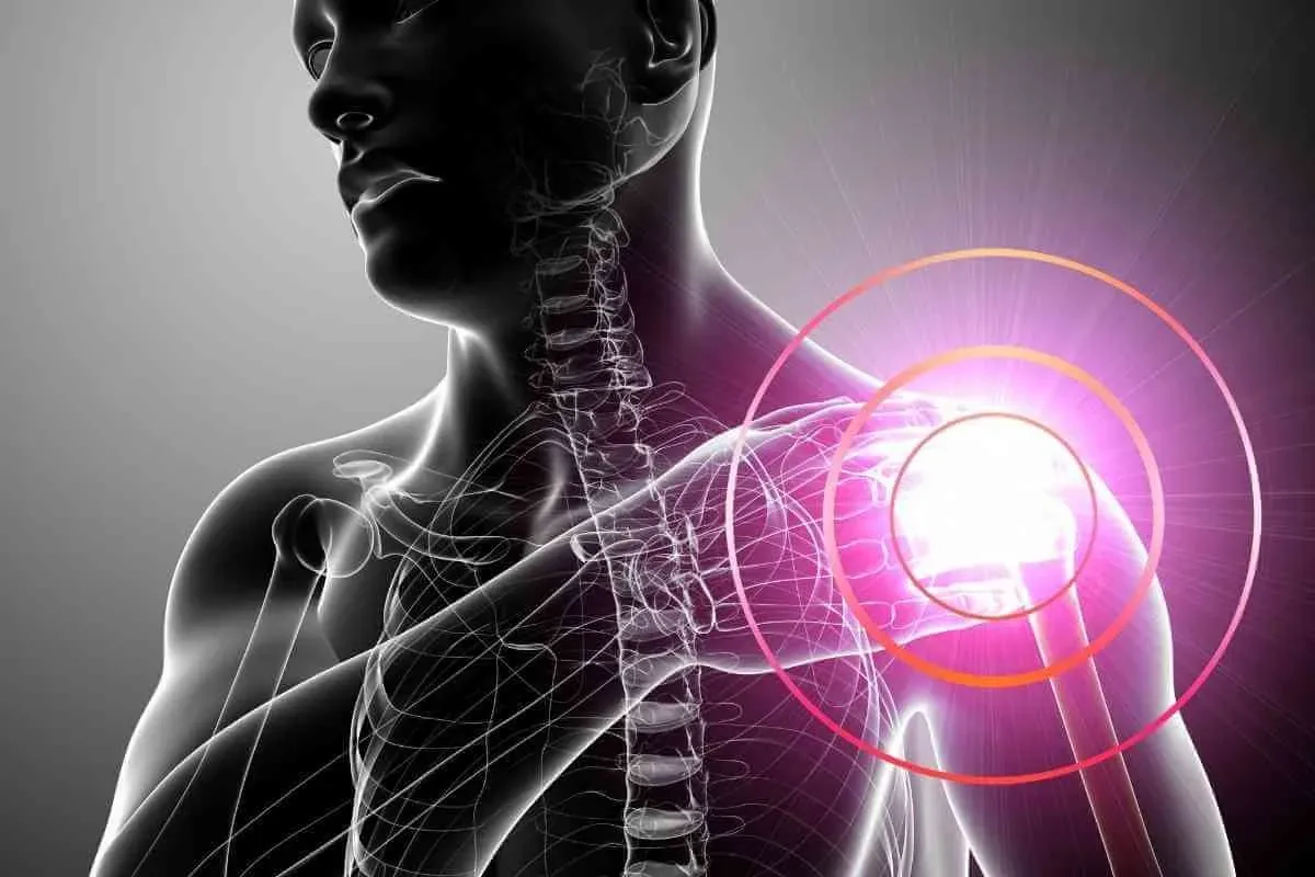 Cirurgia de ligamento do tendão do ombro: saiba como é