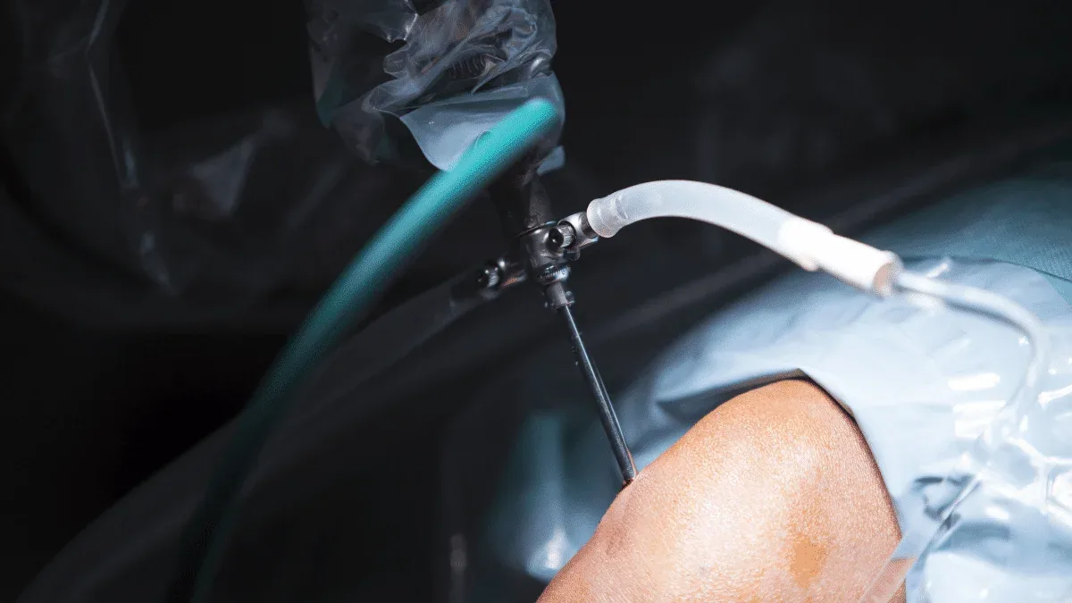 Cirurgia no joelho tem risco de morte?