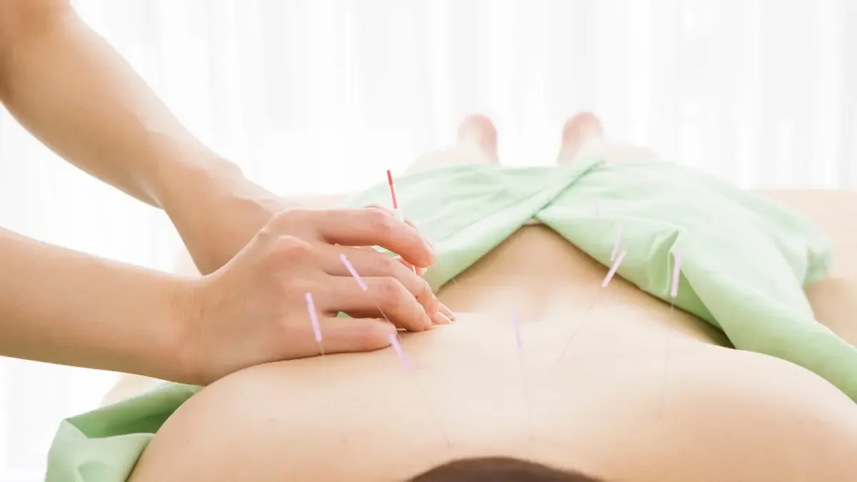 Clínica De Acupuntura: Conheça o COE Centro de Ortopedia