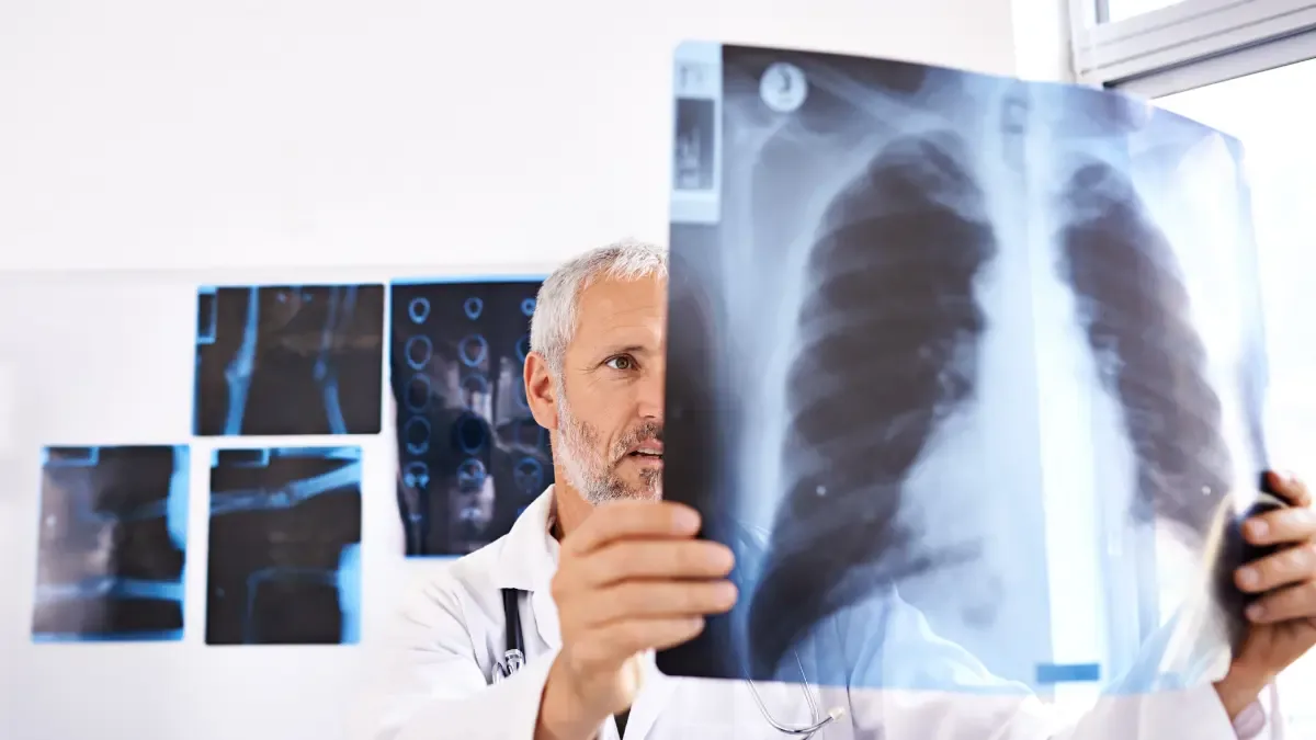 Costela quebrada: Guia completo para recuperação e cuidados