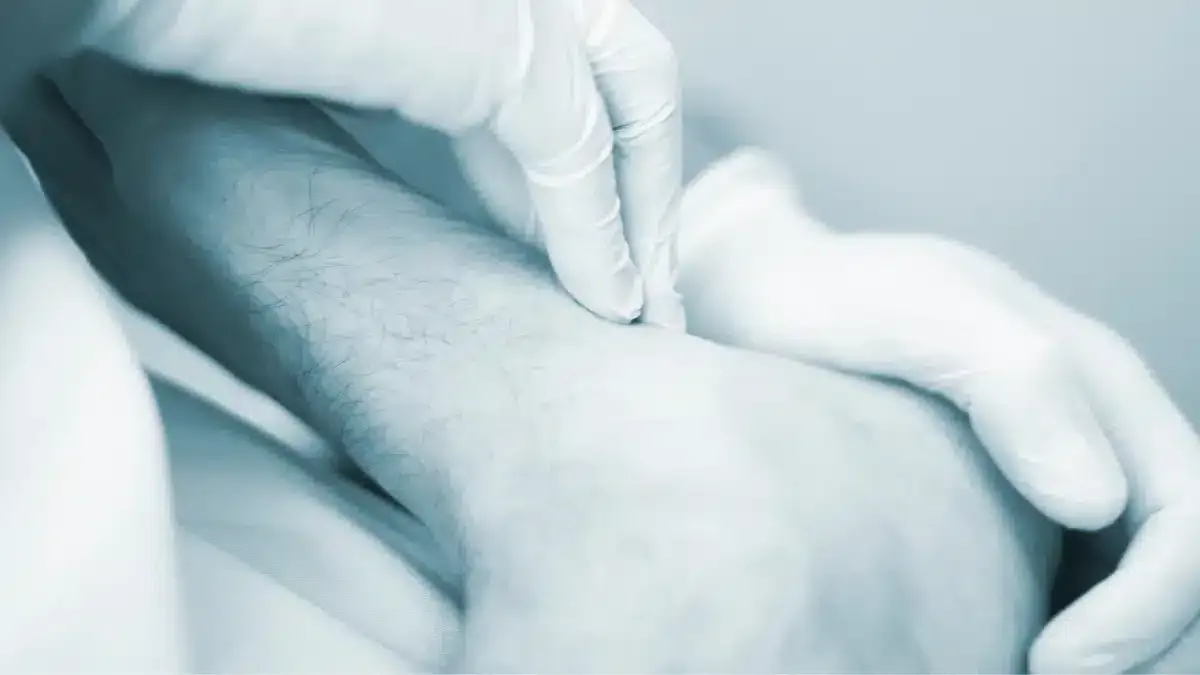 Fisioterapia No Tornozelo Após Cirurgia: É Necessário Fazer?
