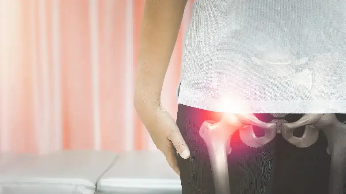 Fratura de quadril: Guia completo de tratamento e prevenção