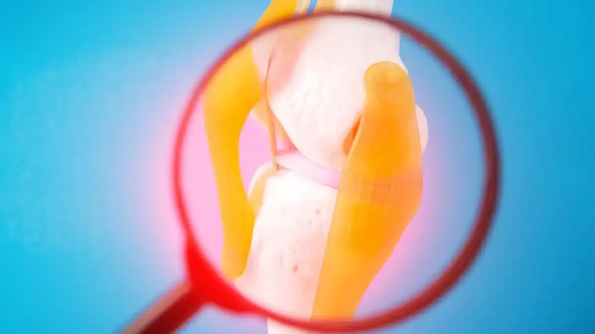 Osteocondrite: Entendendo e Tratando a Condição