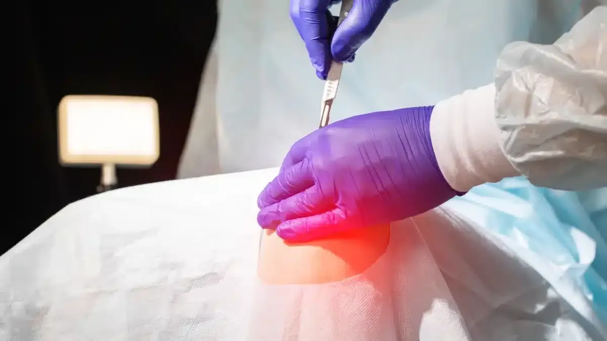 Osteotomia: Procedimento, Recuperação e Cuidados