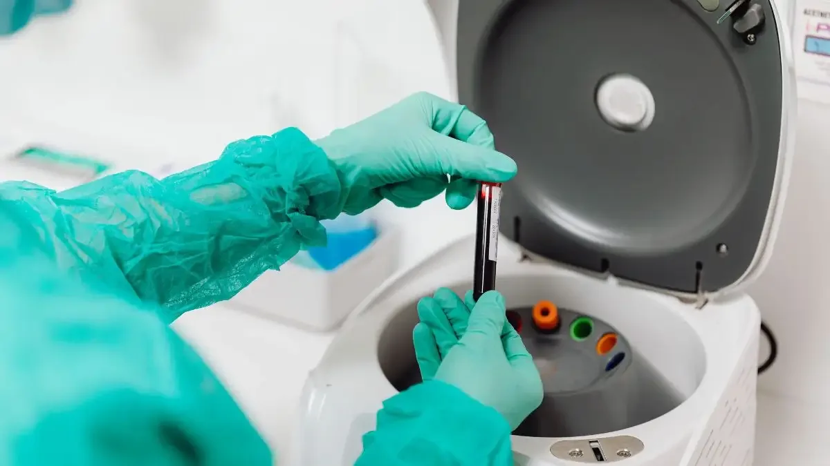 PRP para reparo no menisco