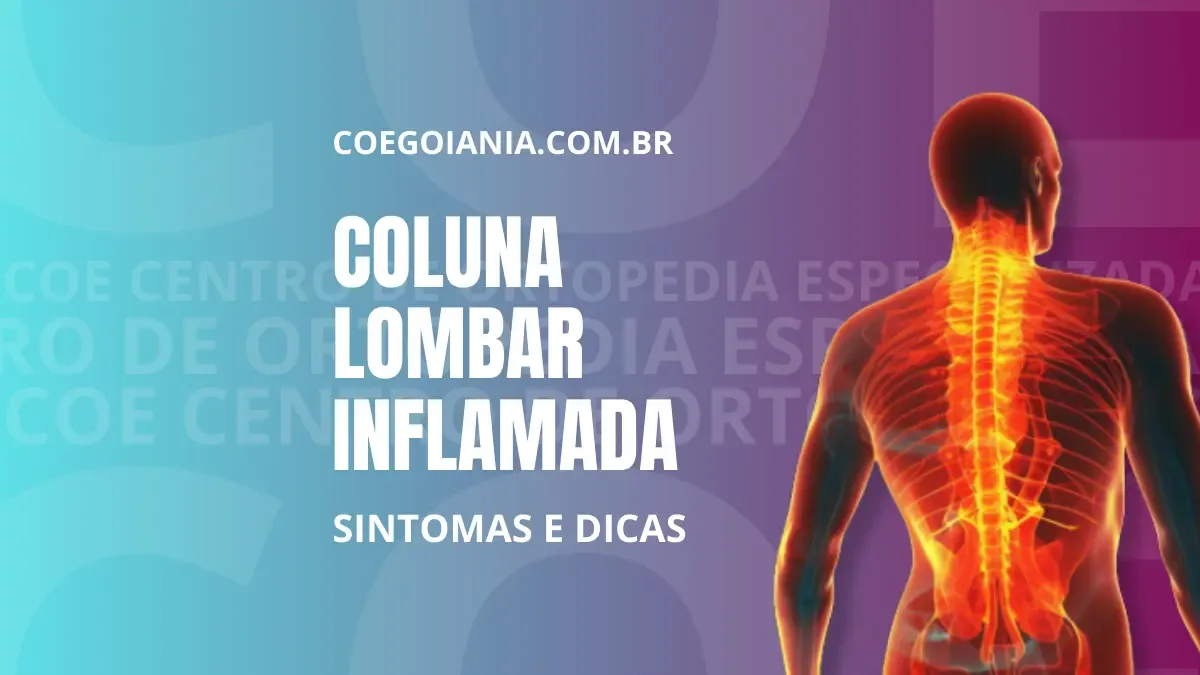 Sintomas de coluna lombar inflamada: como aliviar a dor