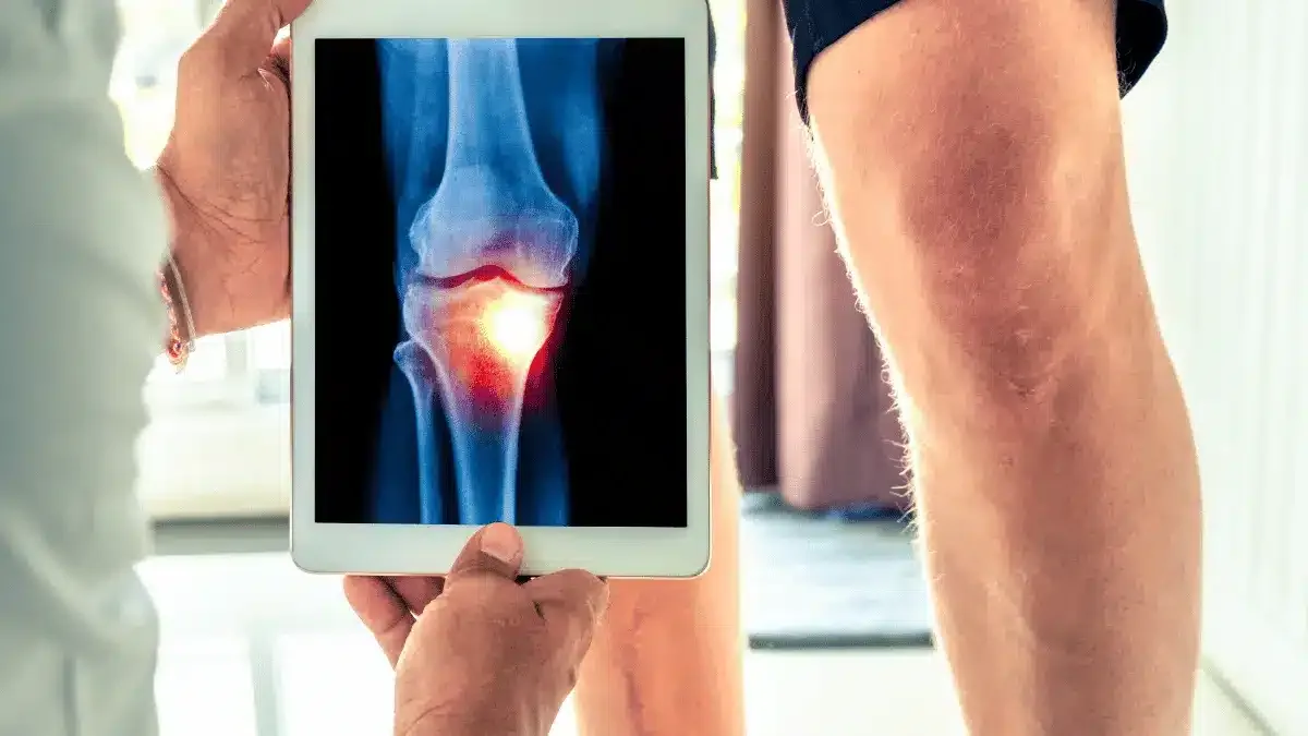 Tumor no joelho é perigoso?
